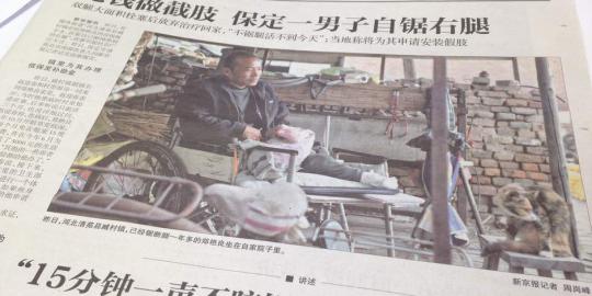 Tak sanggup bayar rumah sakit, pria China amputasi kaki sendiri
