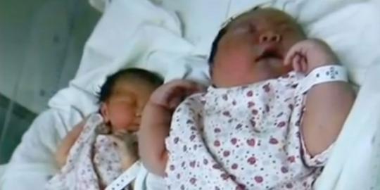 Ibu di China lahirkan bayi raksasa berbobot 6,18 kg