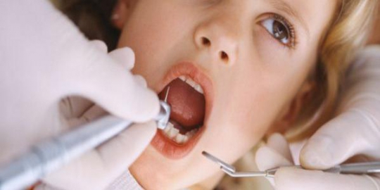 waspadai 6 hal yang menyebabkan gusi berdarah