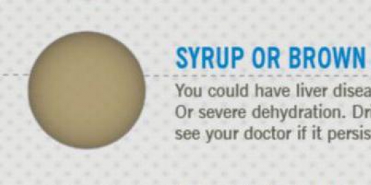 kenali masalah kesehatan dari warna urine!