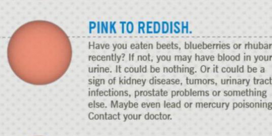 kenali masalah kesehatan dari warna urine!