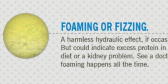 kenali masalah kesehatan dari warna urine!