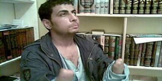 Tobat jadi maling, pemuda Mesir amputasi tangannya