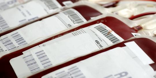 5 Hal yang harus diketahui sebelum dan sesudah melakukan donor darah