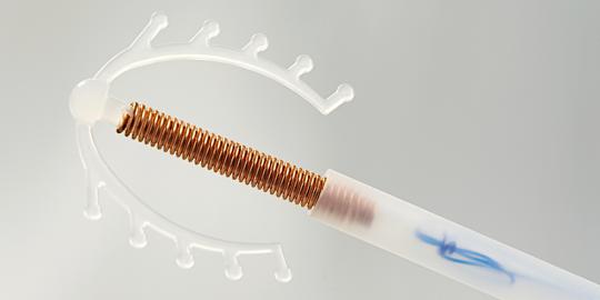 5 Hal yang harus diketahui tentang alat kontrasepsi IUD