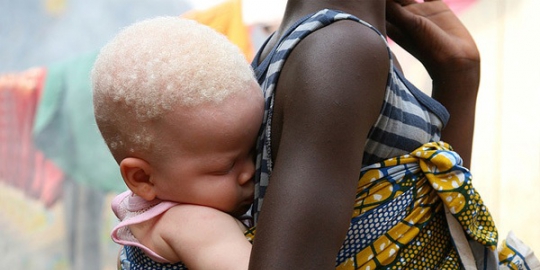 albino di tanzania rev1