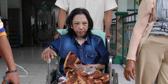 Kondisi prihatin Erwiana, TKI korban kekerasan di Hong Kong