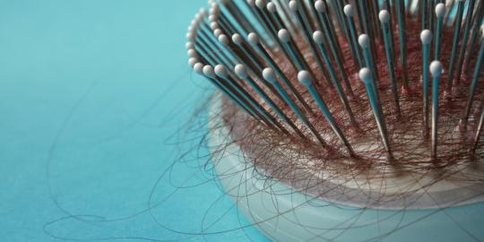 4 Bahan alami untuk mengobati rambut rontok