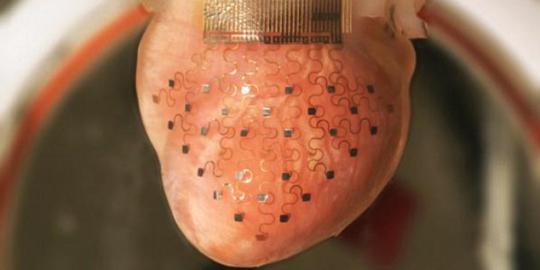 Peneliti ciptakan membran untuk cegah serangan jantung