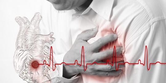 serangan jantung adalah sakit pada dada