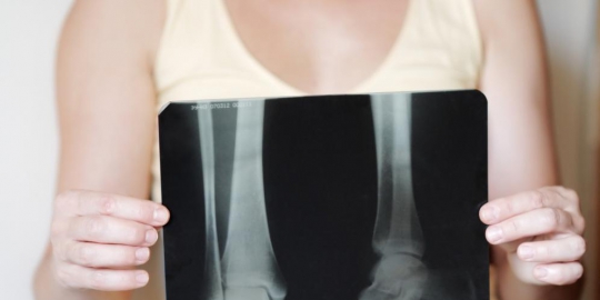5 penyakit yang paling rentan menyerang wanita