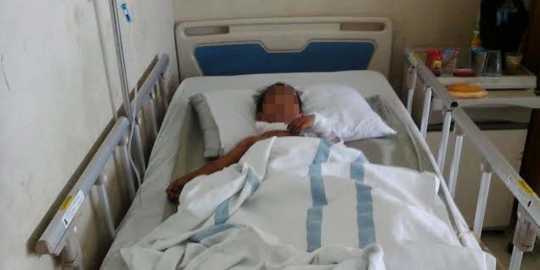 Bocah yang disetrika ibu tiri sering diajak ngamen ayahnya