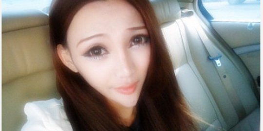 Ingin cantik lewat oplas, gadis ini malah jadi seperti alien