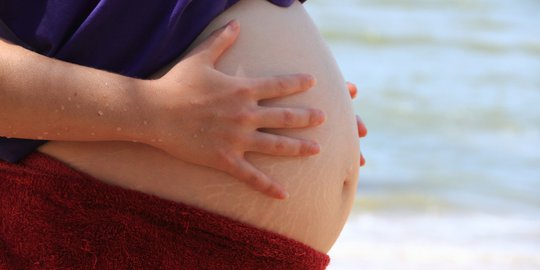 stretch mark