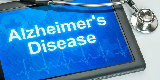 Gen ini mampu tingkatkan risiko wanita terkena penyakit Alzheimer