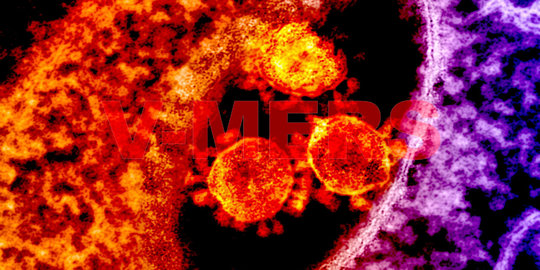 RSHS Bandung rawat tiga pasien diduga suspect virus MERS