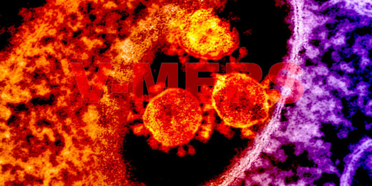Pulang umroh, warga Cianjur diduga terjangkit virus MERS