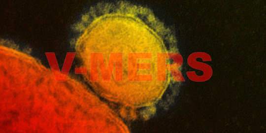 RSHS Bandung rawat bocah dua tahun diduga suspect MERS