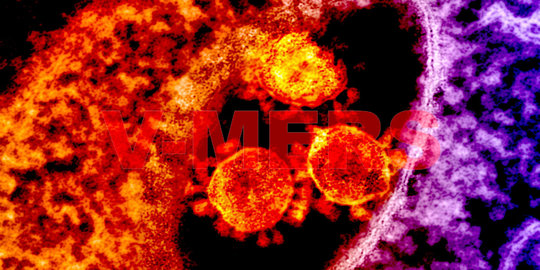 Lagi, RSUP M. Djamil Padang terima 2 Pasien virus MERS