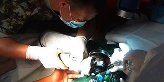 Melukis sambil bugil, penis lelaki China nyangkut di pipa