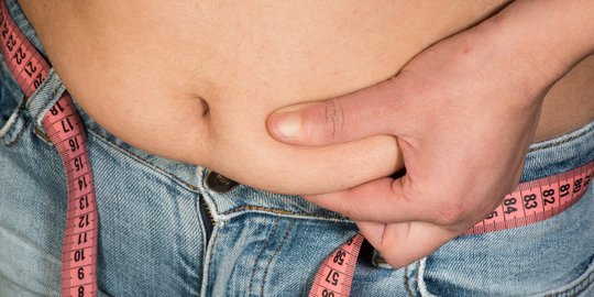 7 Cara Ampuh Hilangkan Stretch Mark Merdeka Com