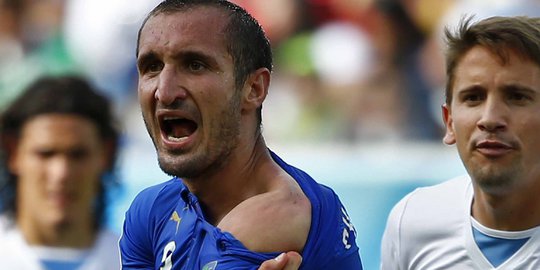 Ini bahu Chiellini yang jadi korban gigitan Luis Suarez