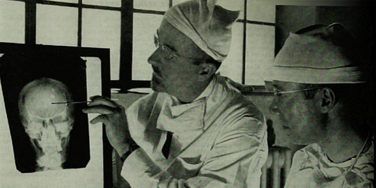 lima metode pengobatan paling menggidikkan sejagat