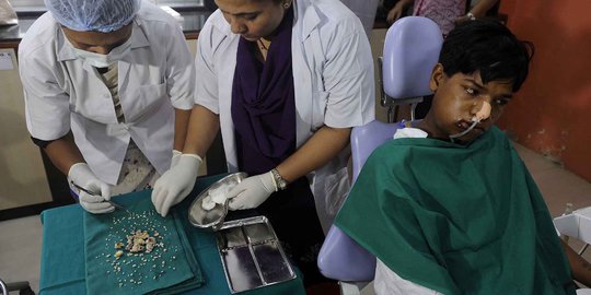 Ahli bedah di India cabut 232 gigi dari mulut seorang remaja