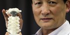 Dokter China ciptakan alat untuk penderita kanker tulang