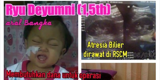 Idap Atresia Bilier Bayi Ryu Butuh Rp 1 M Buat Operasi Hati Merdeka Com