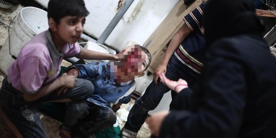 Derita bocah Suriah kembali jadi korban kekejaman pasukan Assad