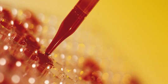 5 jenis tes darah yang perlu dilakukan setiap orang