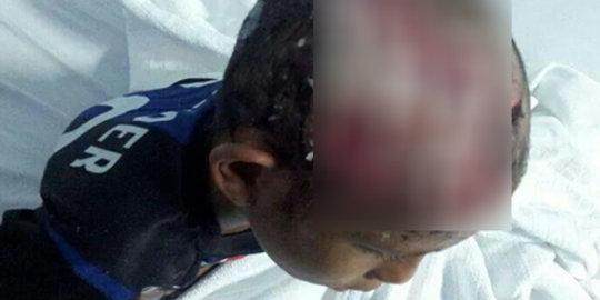 Ogah nyolong, kepala bocah Saudi dikuliti bapaknya