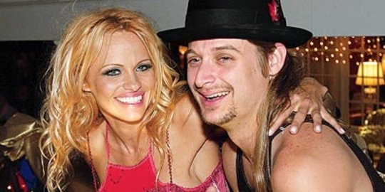 kid rock