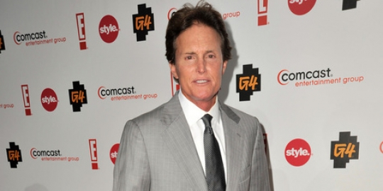 Kaki makin mulus, ayah Kim Kardashian makin mirip wanita 