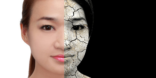 Kenali 5 Hal sederhana yang Bisa Bikin Kulit Kering!