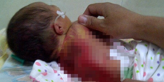 Ini bayi Fadhlan yang tewas kepanasan di dalam inkubator