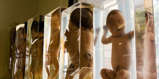 Seram, museum kematian ini pajang mayat bayi sampai kriminal!