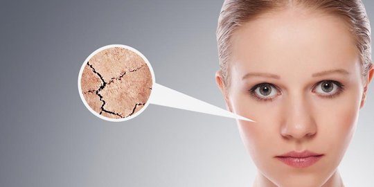 Bahaya Konsumsi Gula Berlebihan Bagi Kecantikan