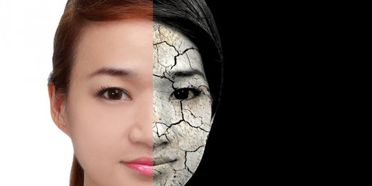 Bahaya Konsumsi Gula Berlebihan Bagi Kecantikan