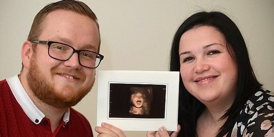 Bayi belum lahir ini tersenyum dalam perut ibunya