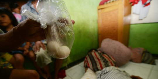Dinkes: Telur yang dikeluarkan Sinin telur ayam sudah 3 Minggu