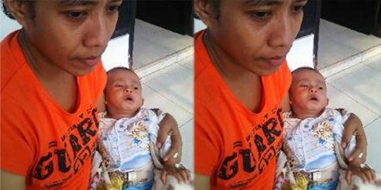 Tak ada biaya, bayi tanpa anus di Bali numpang di Yayasan