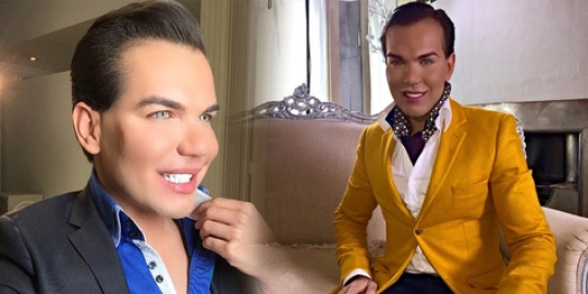 30 kali operasi plastik, Rodrigo Alves habiskan miliaran rupiah