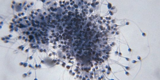 1500 sperma setiap jantungnya berdetak