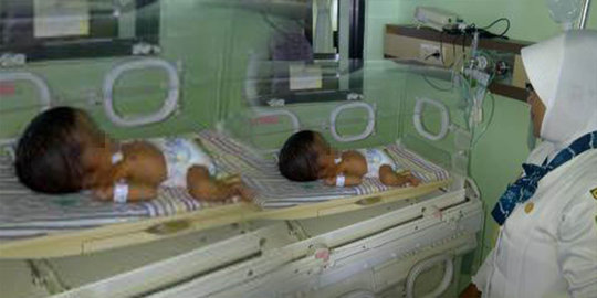 Bayi hydrocephalus lemas di incubator, butuh uluran tangan dermawan