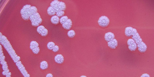 Bakteri mematikan menyebar dari laboratorium Amerika