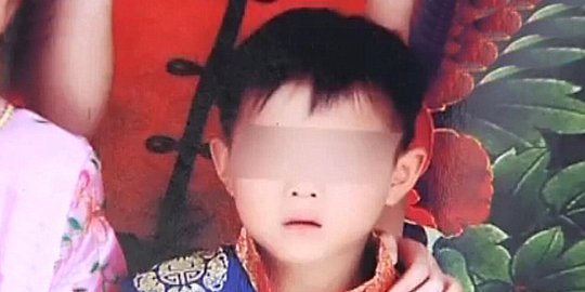 Main petak umpet sambil makan permen lolipop, bocah ini meningggal