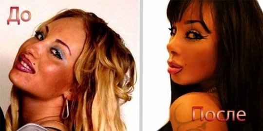 tahun gadis ini sudah oplas 13 kali