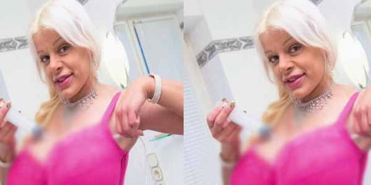 model wanita ini perbesar payudara